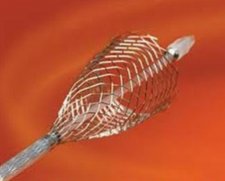 Boston Scientific Carotid Wallstent Monorail Endoprosthesis | Used in Carotid stenting  | Which Medical Device